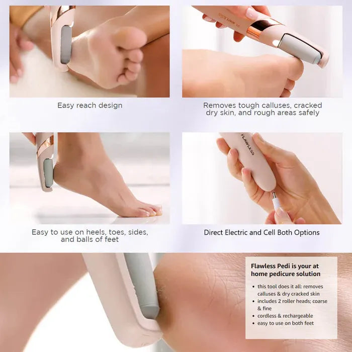 Callus Remover Device